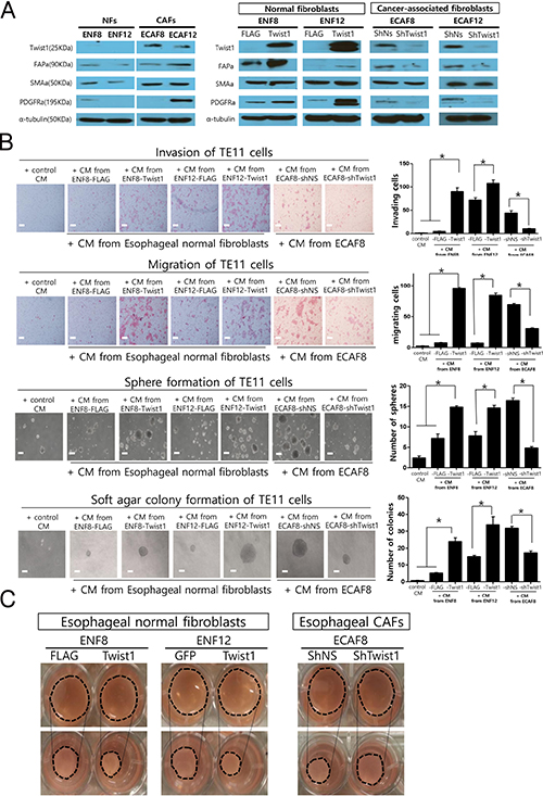 The in vitro effects of Twist1 expression in esophageal cancer-associated fibroblasts (CAFs) and normal fibroblasts (NFs) on the progression of esophageal cancer cells and the contraction ability of fibroblasts.
