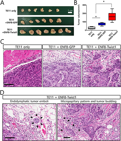 The overexpression of Twist1 in esophageal normal fibroblasts enhanced in vivo tumorigenicity of esophageal cancer cells.