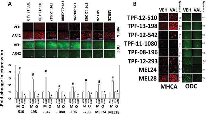 HDAC inhibitors regulate the expression of MHCA and ODC in melanoma cells.