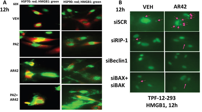 AR42 promotes the extracellular release of HMGB1 and HSP70 from melanoma cells.