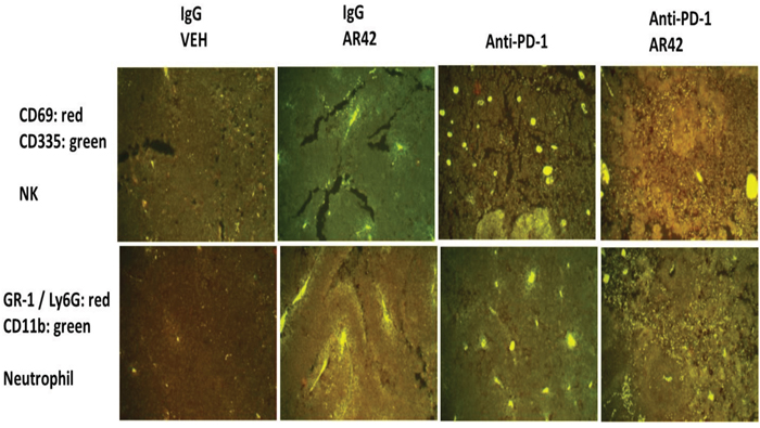 Natural Killer and neutrophil levels in drug treated tumors (1).