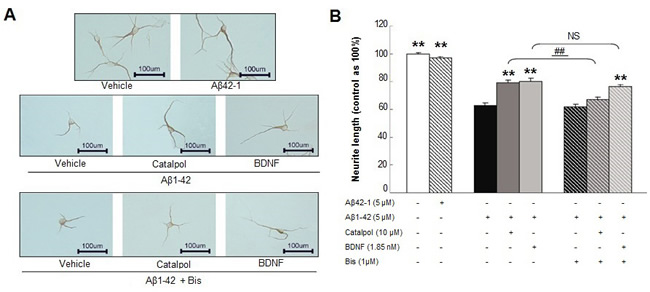 The effects of catalpol (10 &micro;M) and BDNF (1.85 nM) on the growth of MAP-2-positive neurite treated with A&#x3b2;