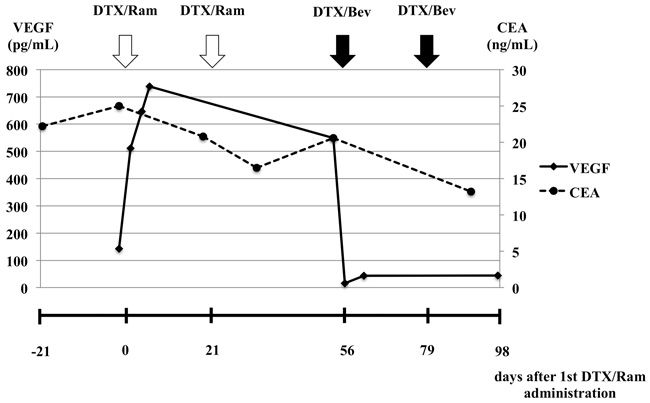 Changes in serum VEGF and carcinoembryonic antigen levels before and after ramucirumab plus docetaxel and bevacizumab plus docetaxel combination therapy.