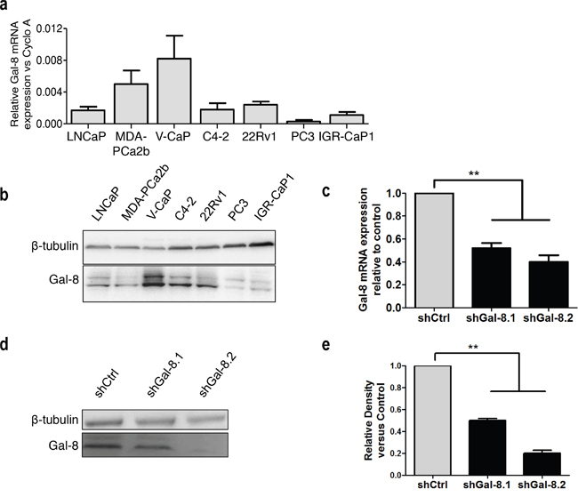 Galectin-8 expression profile in human PCa cell lines and metastatic model of prostate cancer.