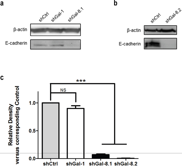 E-Cadherin expression is correlated with Gal-8 expression in IGR-CaP1.