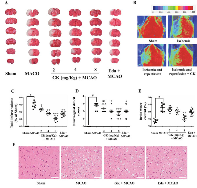 GK ameliorates I/R-induced brain injury.