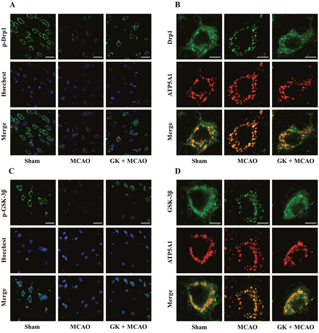 GK attenuates Drp1 and GSK-3&#x03B2; mitochondrial translocation caused by I/R injury in the mouse brain.