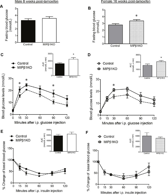 MIP&#x03B2;1KO mice show impaired glucose metabolism.