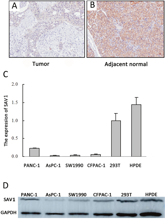 Expression of SAV1 in pancreatic cancer tissues and cell lines.
