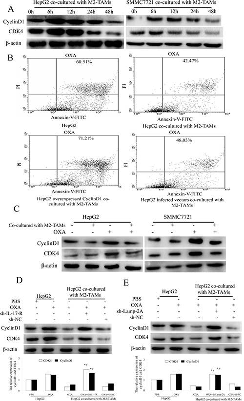 IL-17 reduces cyclin D1 expression by activating CMA.