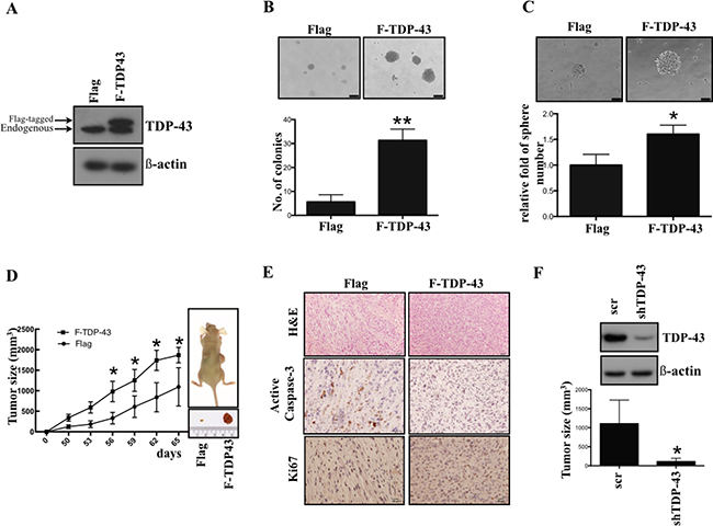 TDP-43 is essential for tumor progression in vitro and in vivo.