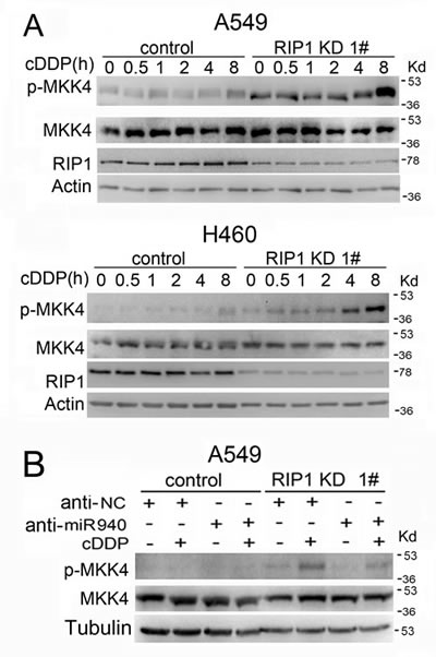 Cisplatin-induced MKK4 activation is enhanced in RIP1 knockdown cells.