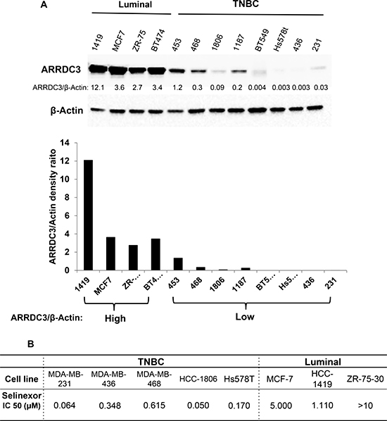 TNBC subtype breast cancer cells are more sensitive to the cytotoxic effects of selinexor than luminal subtype breast cancer cells and their sensitivity is inversely correlated with ARRDC3 basal levels of expression.