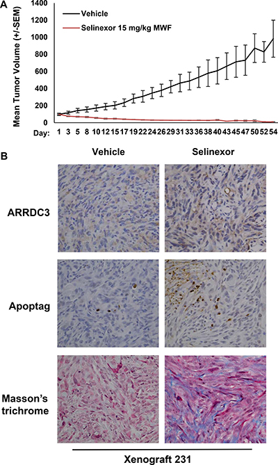 Selinexor effectively inhibited TNBC cell-derived xenograft tumors in mice while restoring ARRDC3 expression.