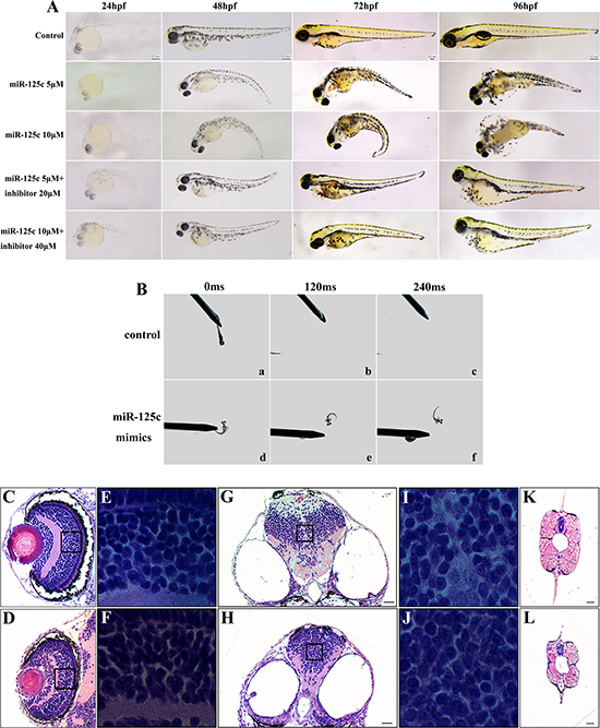 Overexpression of miR-125c results in severe abnormalities and reduction of motility during embryonic development.