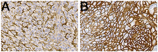 Representative IHC images of CD44v6 stainings of UM-SCC-74B (A) and A431 (B) xenografted tumors