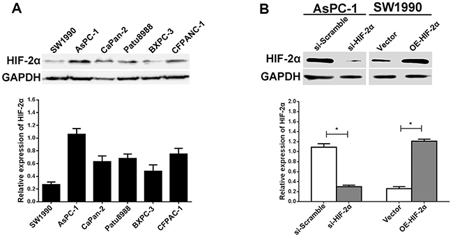 Expression of HIF-2&#x03B1; in pancreatic cell lines and regulation of HIF-2&#x03B1; in AsPC-1 and SW1990 cells.
