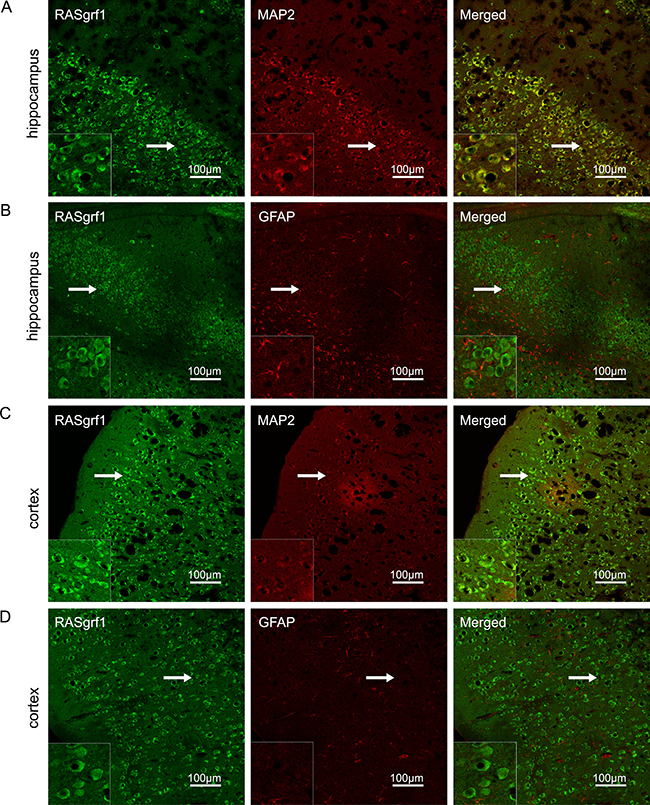 RASgrf1 double-labeling immunofluorescence in brain sections from KA-treated mice.