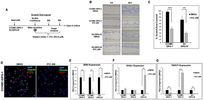 PTC-209 treatment inhibits the invasive properties of DIPG and downregulates the EMT factors ZEB1 and Vimentin.
