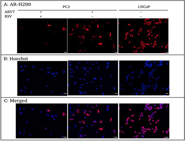 PC-3 cells were transiently transfected with plasmid expressing ARV7 and treated with or without RSV for 24 hours.