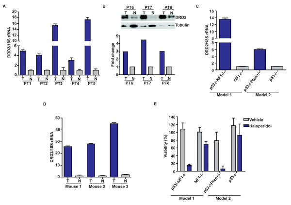 Increased DRD2 expression in glioblastoma specimens.