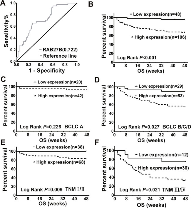 Serum expression of RAB27B in patients with hepatocellular carcinoma (HCC) was related to overall survival time and malignancy.