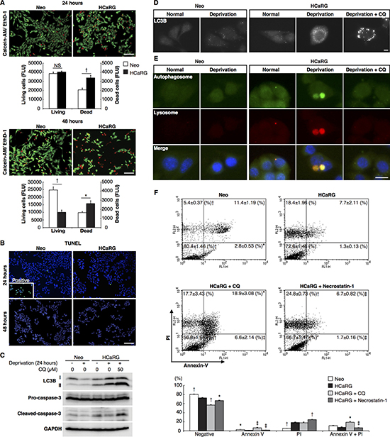 HCaRG induces autophagic cell death distinct from apoptosis or necroptosis in Renca cells.