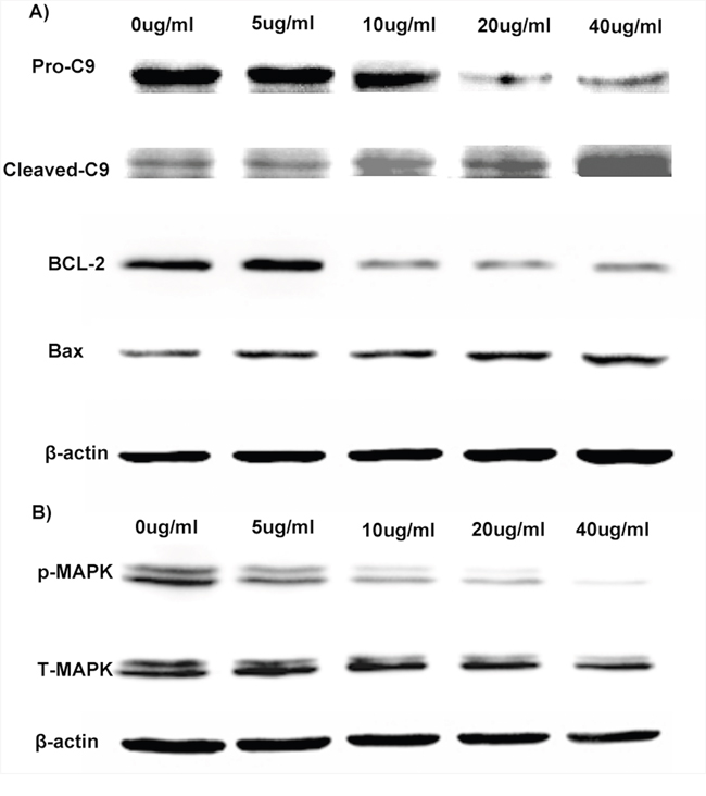 Anti-glioma molecular mechanism of Luteolin/MPEG-PCL micelles.