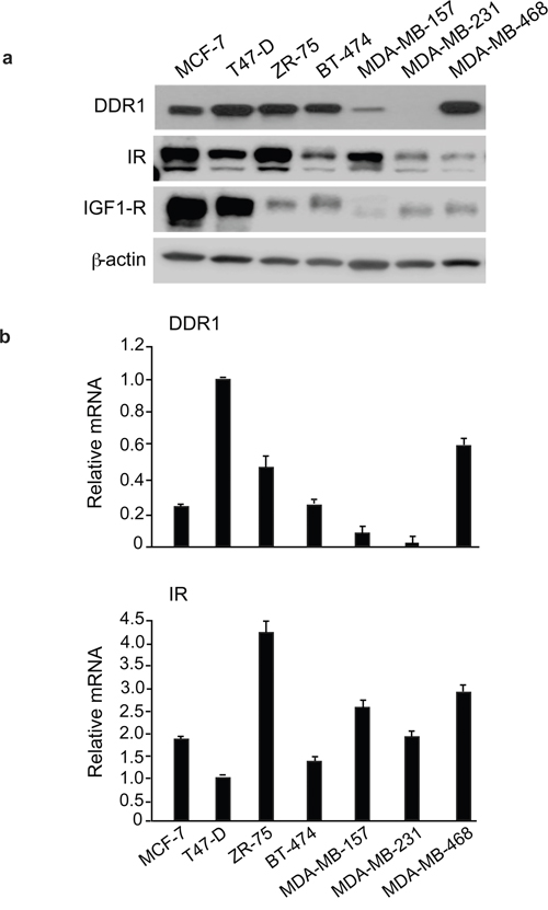 IR, DDR1 and IGF-1R expression in cultured cells.