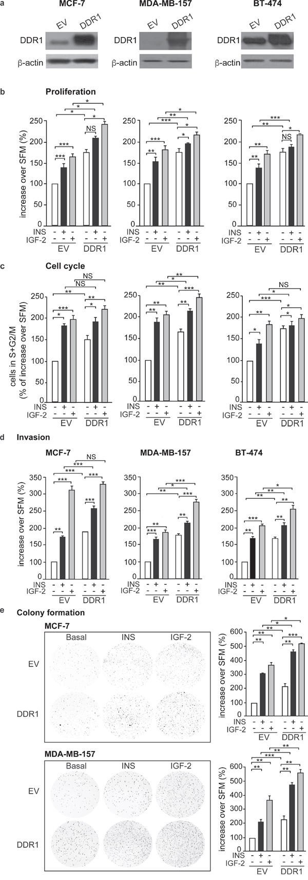 DDR1 overexpression affects insulin and IGF-2 mediated biological effects in human cancer cells.