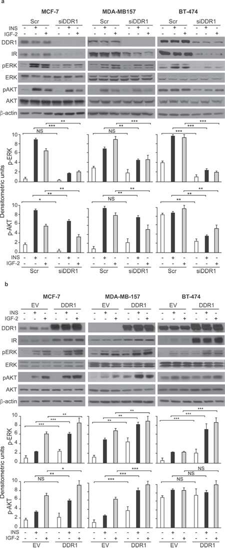 DDR1 depletion or overexpression affects insulin and IGF-2 downstream signaling in human breast cancer cells.