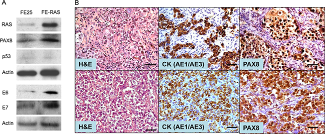 Characterization of a RAS-transformed human fimbria epithelial cell line.