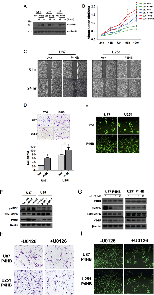 Transient over-expression of P4HB promoted glioma cell proliferation, migration, invasion and tube formation ability in vitro.