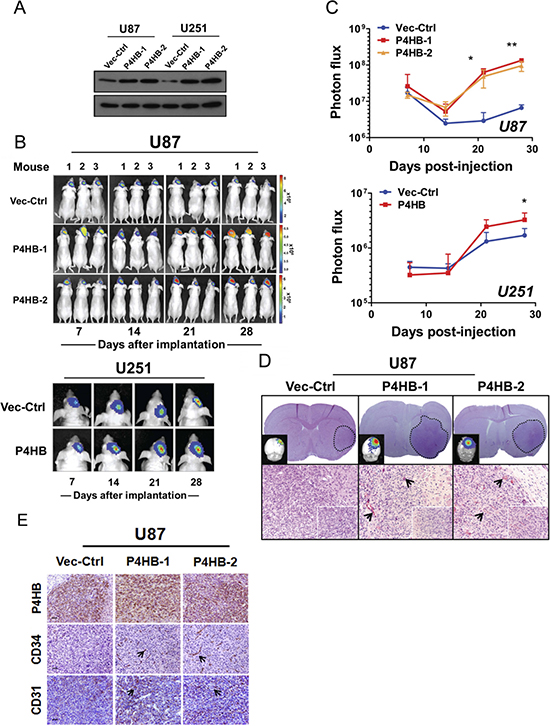 Stable P4HB over-expression was associated with increased tumour growth in vivo in an orthotropic glioma model.