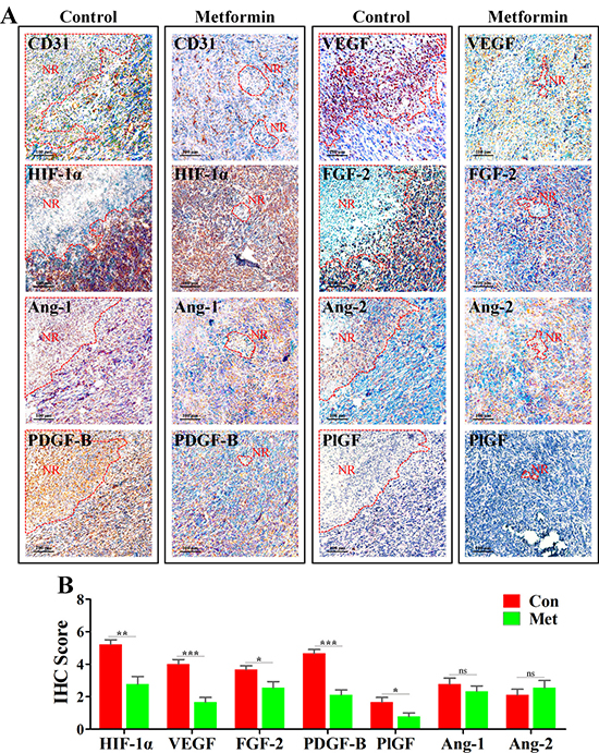 Metformin inhibited angiogenesis in peri-necrotic region by impeding HIF-1&#x03B1;-induced expressions of pro-angiogenic factors.