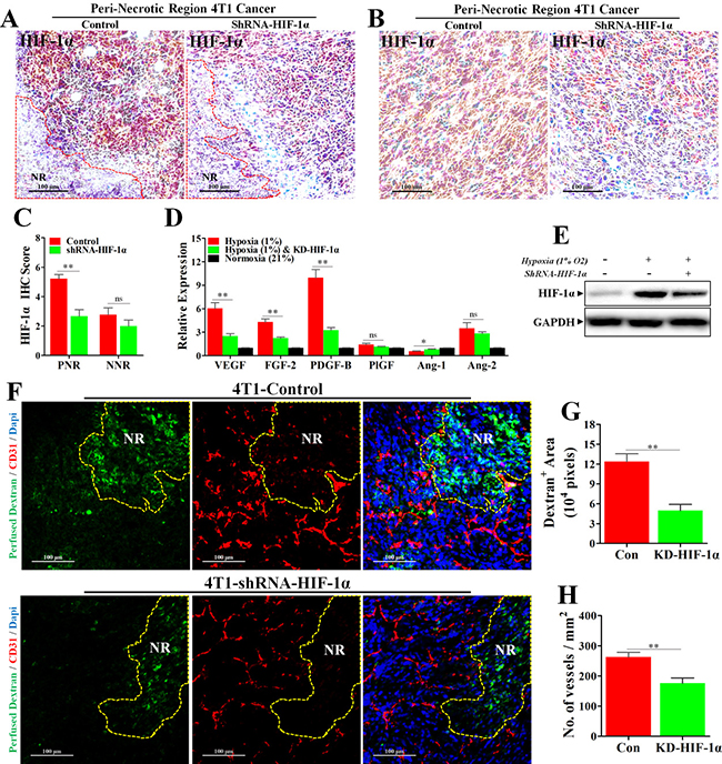 Knock-down of HIF-1&#x03B1; inhibited hypoxia-induced abnormal angiogenesis and reduced vessel leakage.