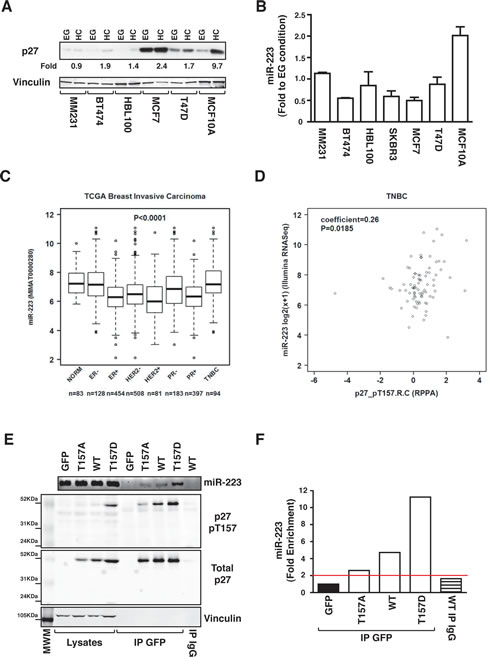 p27-miR-223 axis is deregulated in breast cancer