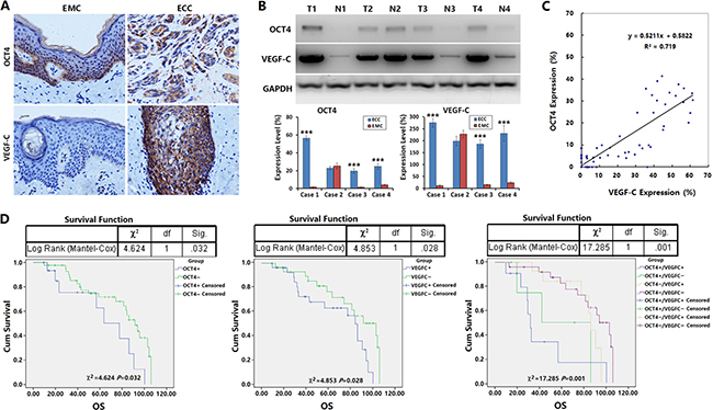 OCT4 promoted the lymphatic metastasis of ECC and affected prognosis of patients.