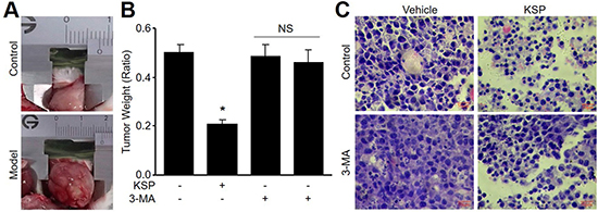 KSP suppresses the growth of gastric cancer in mice.
