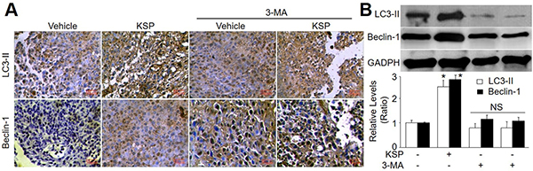KSP increases autophagy of gastric cancer in mice.