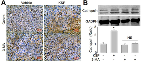 KSP increases the switch from autophagy to apoptotic death of gastric cancer in mice.