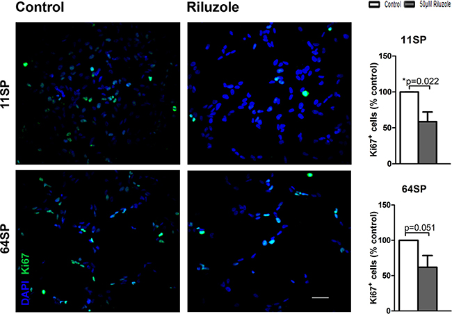 A proliferation analysis of BTSCs after the treatment with riluzole.