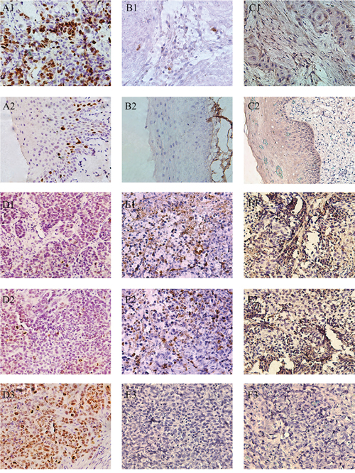 Representative pictures of IHC reflected the expression of Ki-67, cleaved Caspase-3 and E-cadherin in human hypopharyngeal tumor specimens and xenografts.