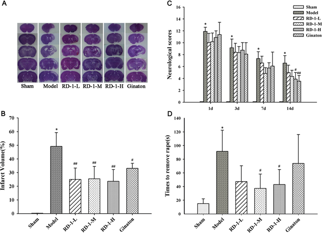 Protective effect of RD-1 against brain injury after cerebral ischemia reperfusion in MCAO rats.