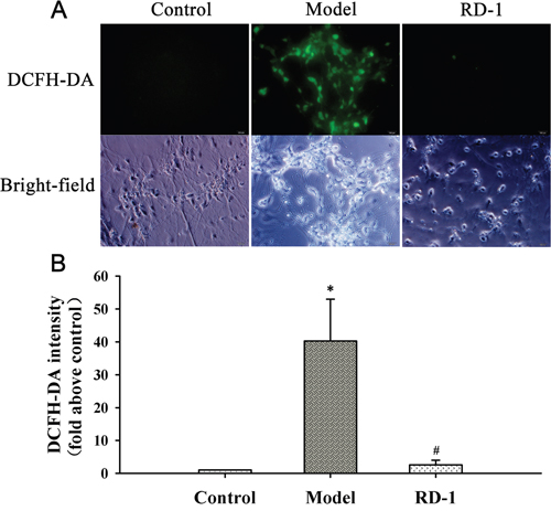 RD-1 reduced the ROS generation in PCNs subjected to OGD/R injury.