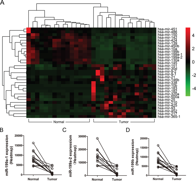 Heatmap analysis of miRNA expression in human HCC patient samples.