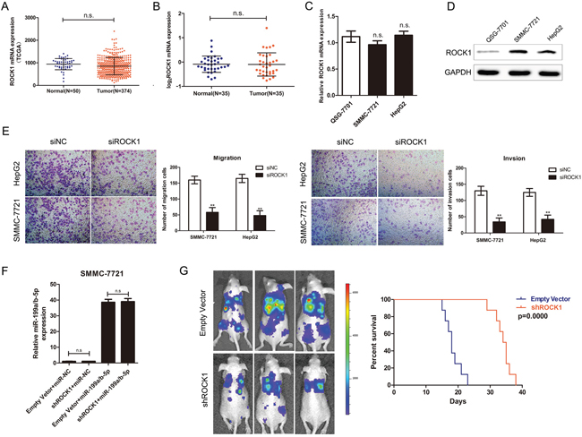 ROCK1 regulates HCC migration, and invasion.