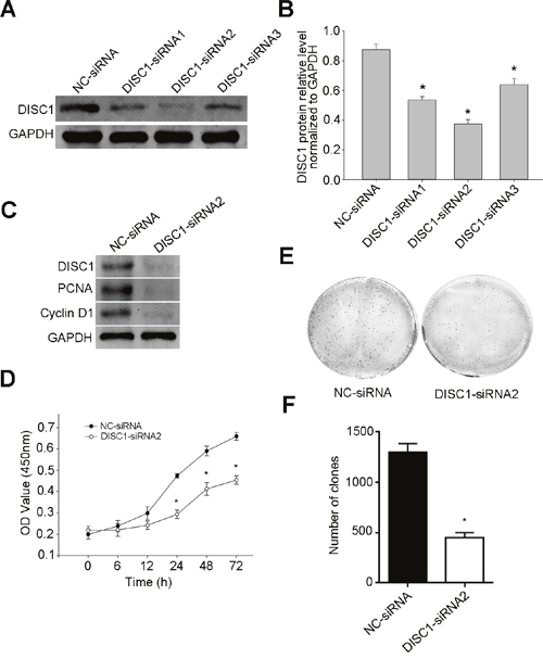 siRNA-mediated DISC1 silencing in NSCLC cells.