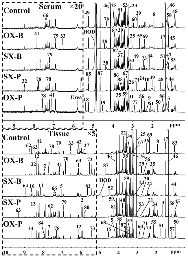 Representative 600 MHz 1H NMR spectra of the serum (top panel) and tissue (bottom panel) samples from control, orthotopic and subcutaneous xenograft (OX and SX) mouse models induced by Panc-1 (-P) and BxPC-3 (-B) cell strains.