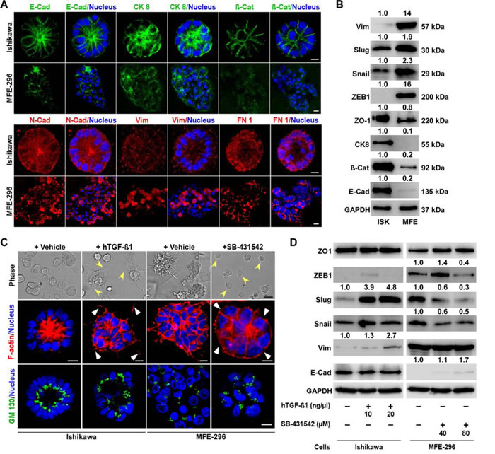 Differential expression of EMT markers in glandular and non-glandular endometrial cancer colonies.